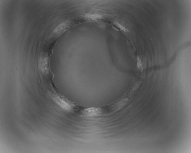 X0000079280526200611251625
