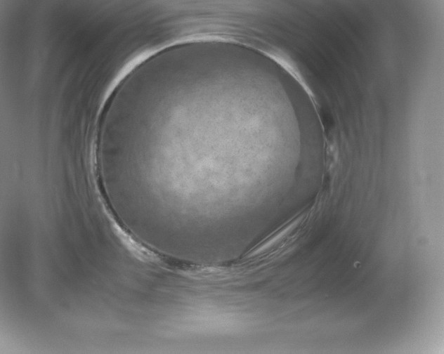 X0000079281101200611251615