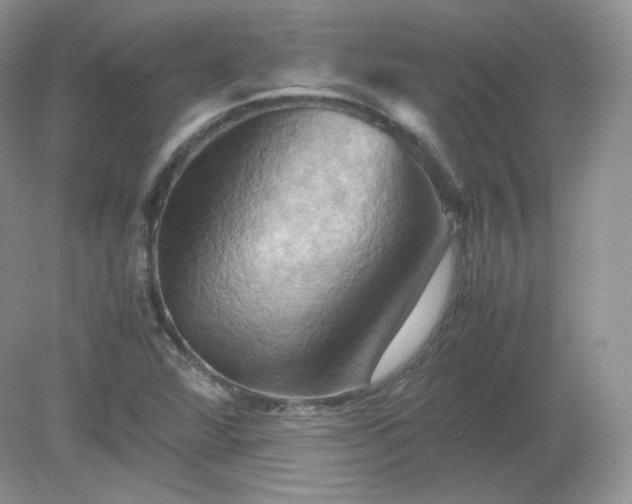 X0000079281360200611251610