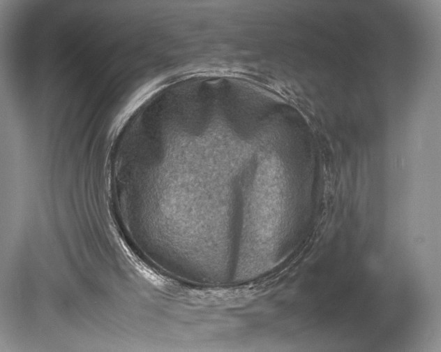 X0000079280005200612011710