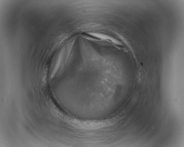 X0000079280018200612011710