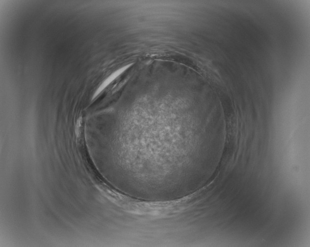 X0000079280033200612011709