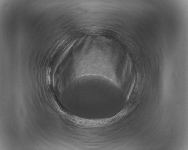 X0000079280048200612011709