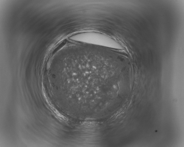 X0000079280145200612011707