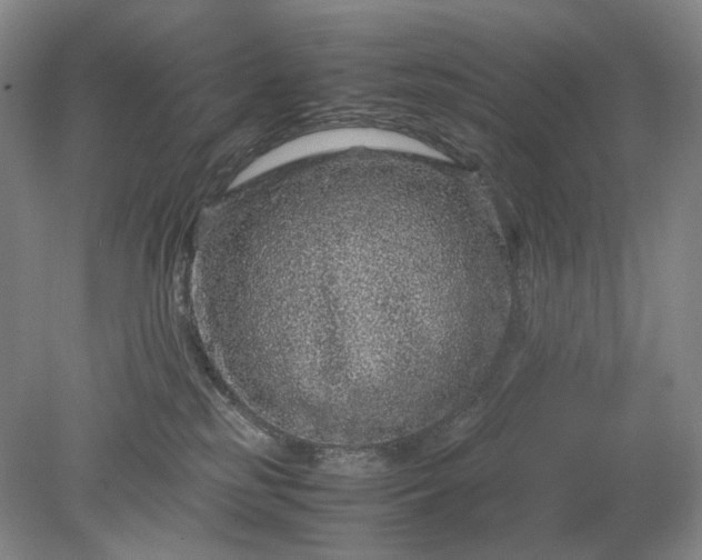 X0000079280185200612011707