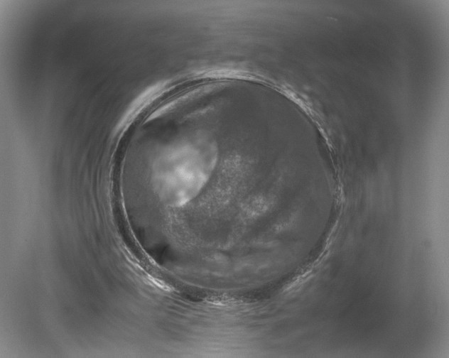 X0000079280199200612011707