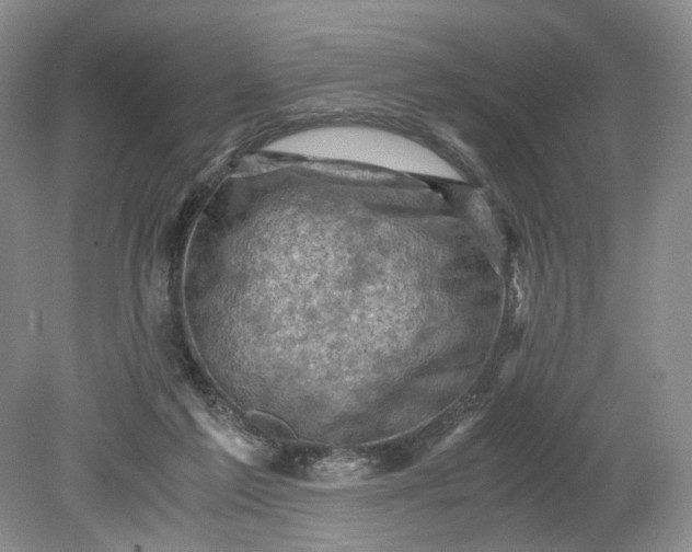 X0000079280213200612011706