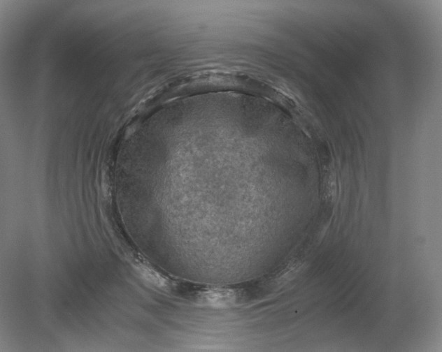 X0000079280317200612011705