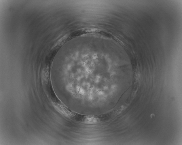 X0000079280376200612011704