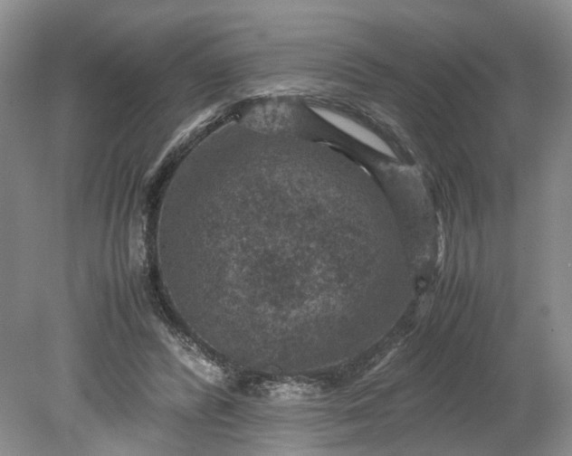 X0000079280400200612011703