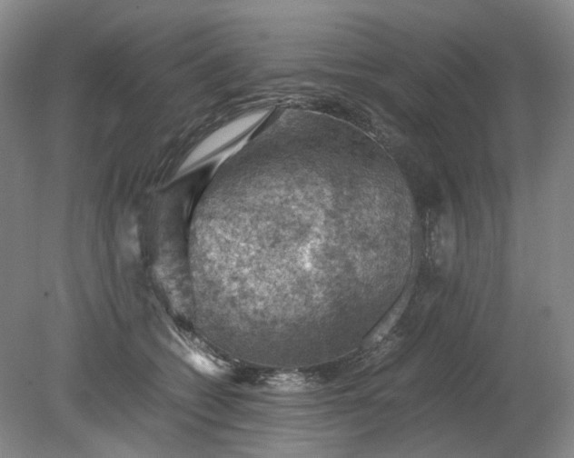 X0000079280562200612011701