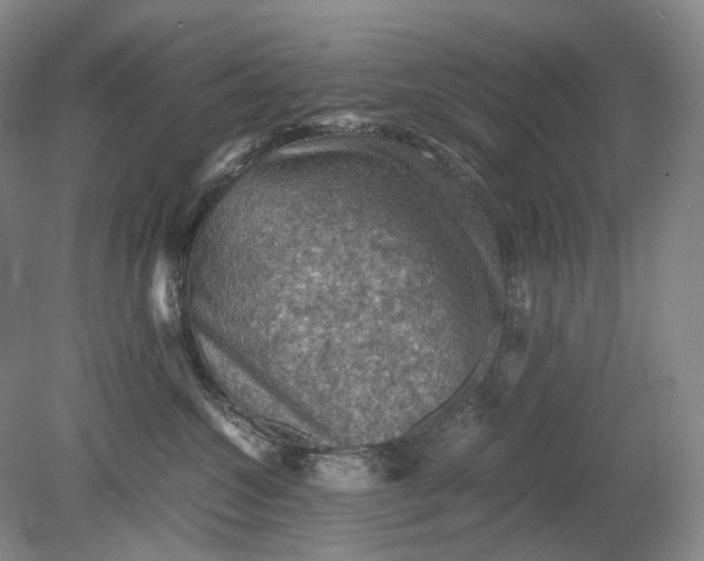 X0000079280572200612011701