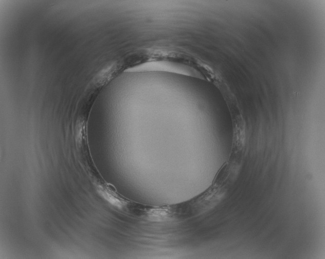 X0000079280574200612011701