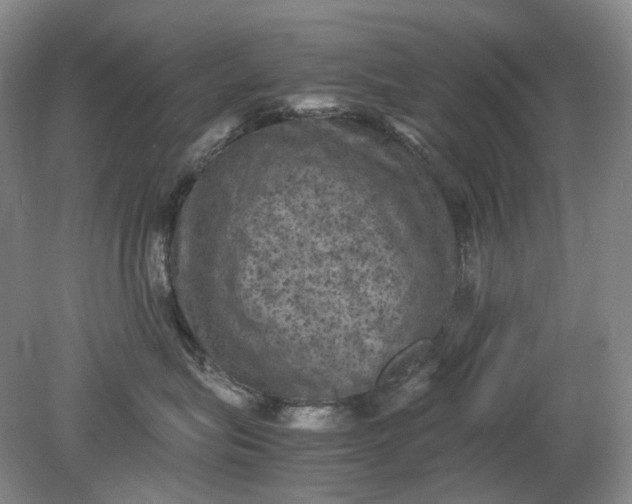 X0000079280575200612011701