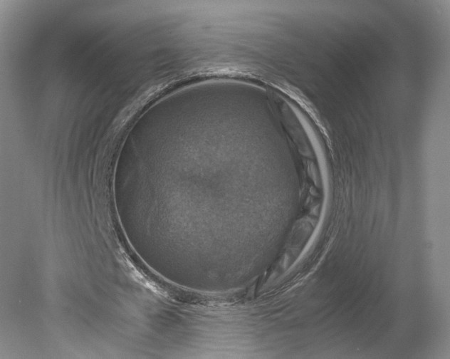 X0000079280577200612011700