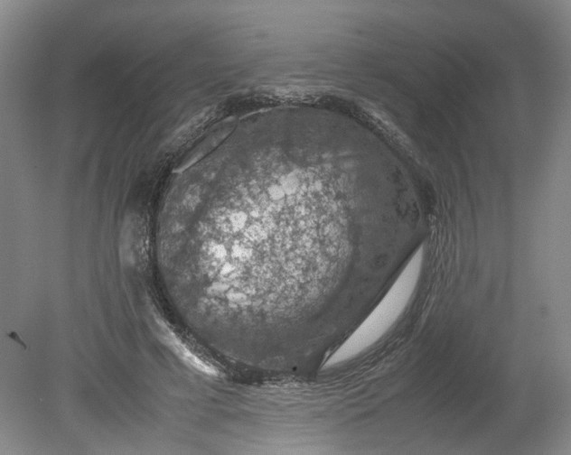 X0000079280593200612011700