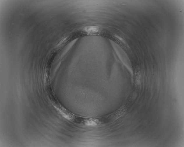 X0000079280618200612011700