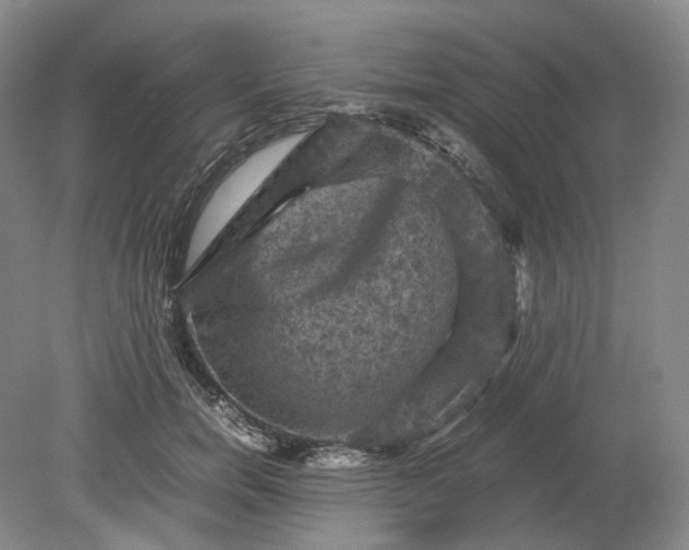 X0000079280750200612011658