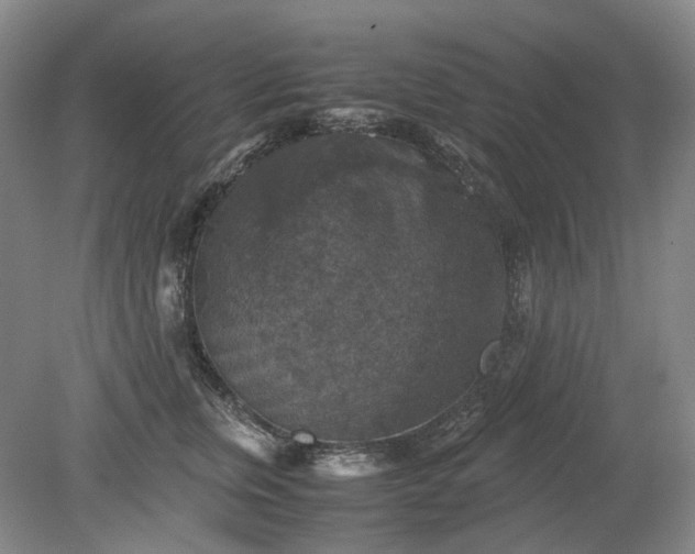 X0000079280759200612011658