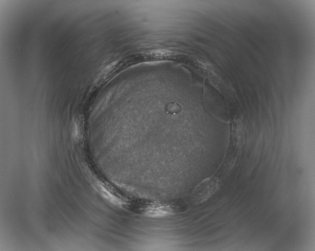 X0000079280760200612011658