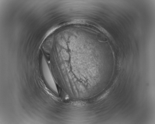 X0000079280830200612011656