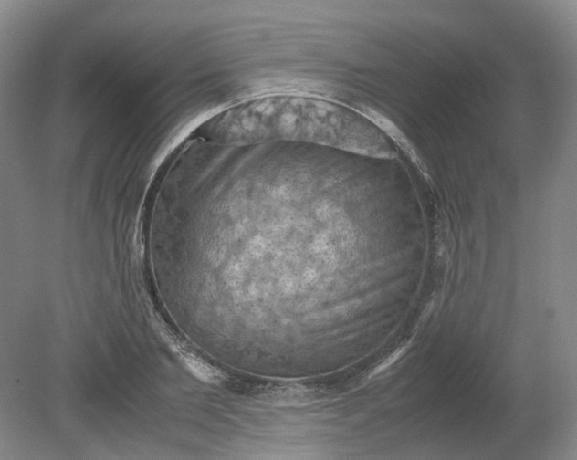 X0000079280885200612011655