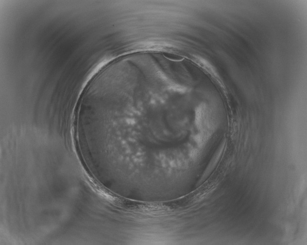 X0000079280899200612011655