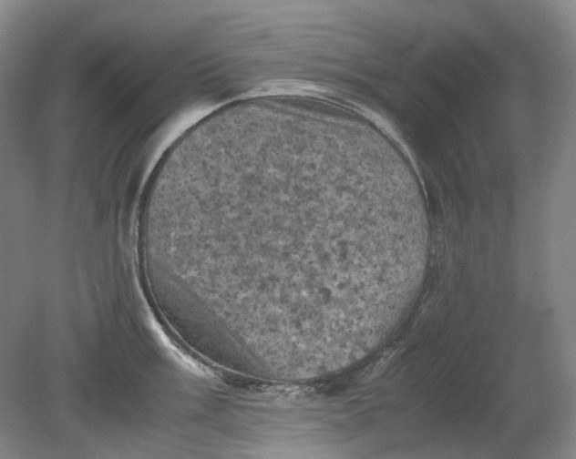 X0000079281003200612011653