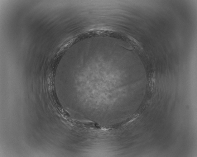 X0000079281014200612011652