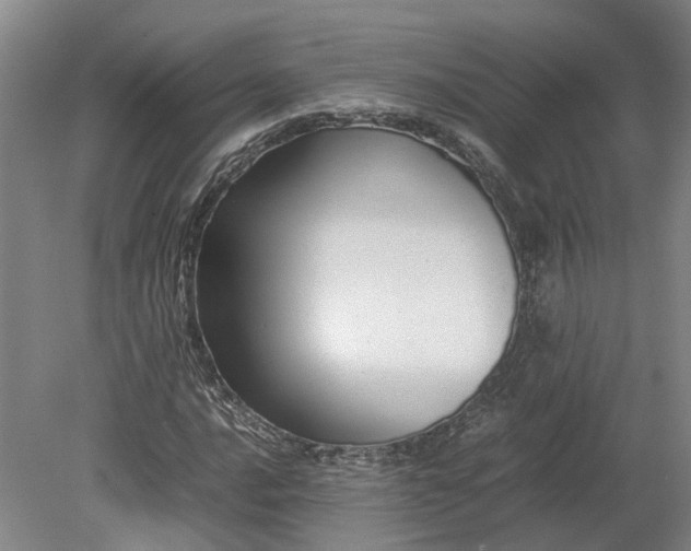 X0000079281016200612011652