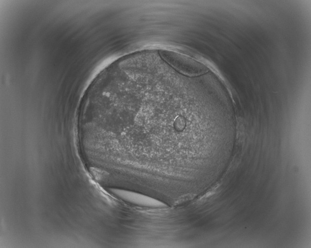 X0000079281048200612011653