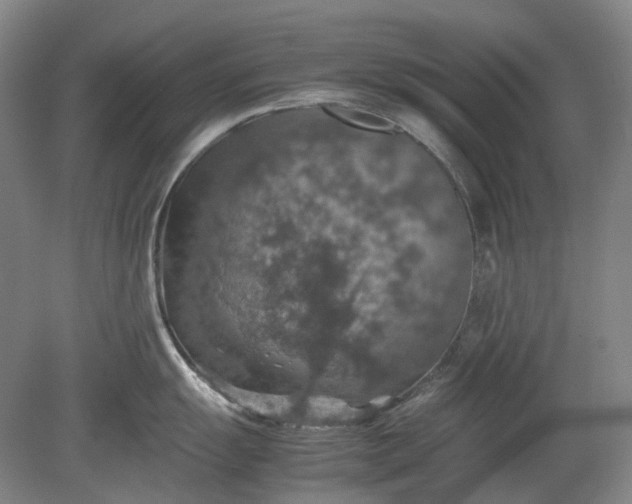 X0000079281055200612011653