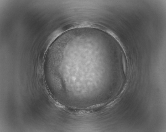 X0000079281097200612011652