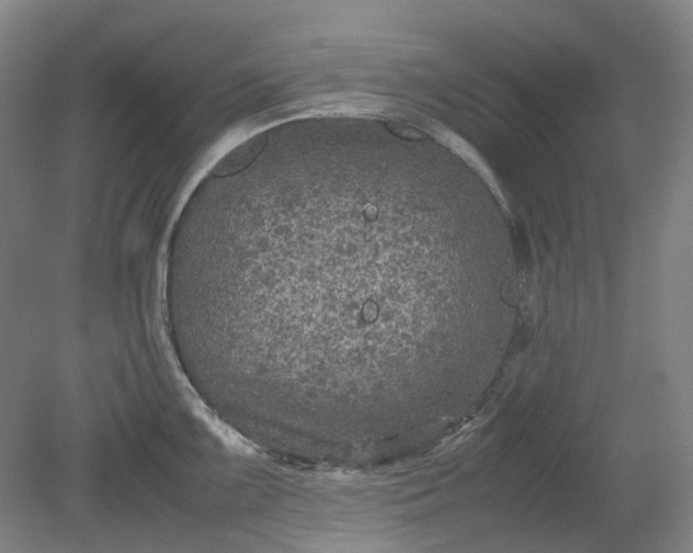 X0000079281099200612011652