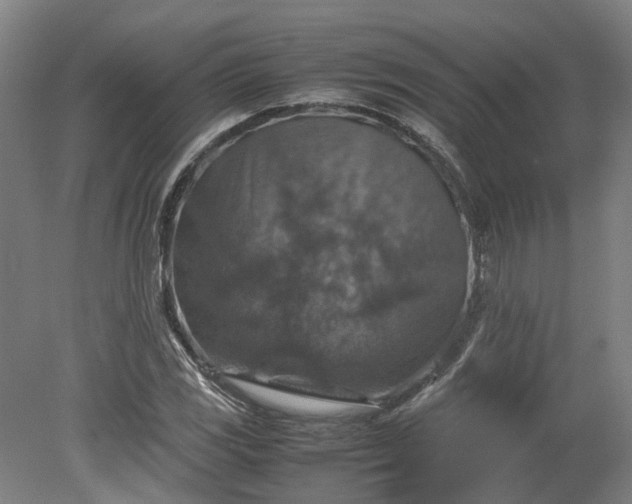 X0000079281117200612011651