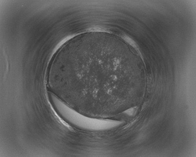 X0000079281141200612011651