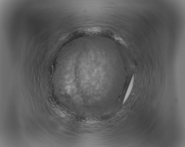 X0000079281153200612011651