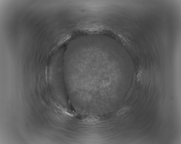 X0000079281156200612011651