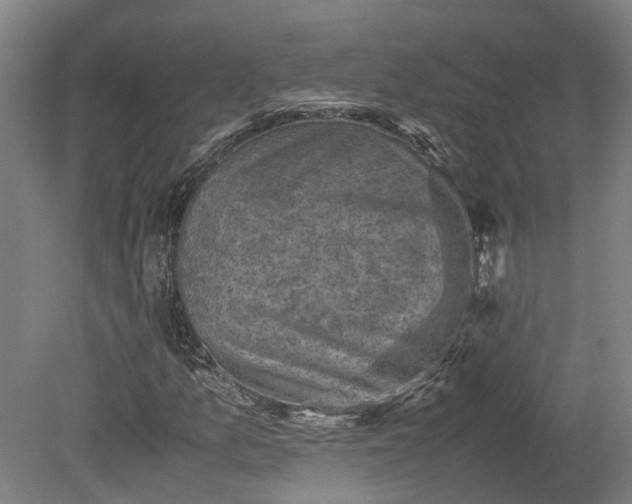 X0000079281157200612011651