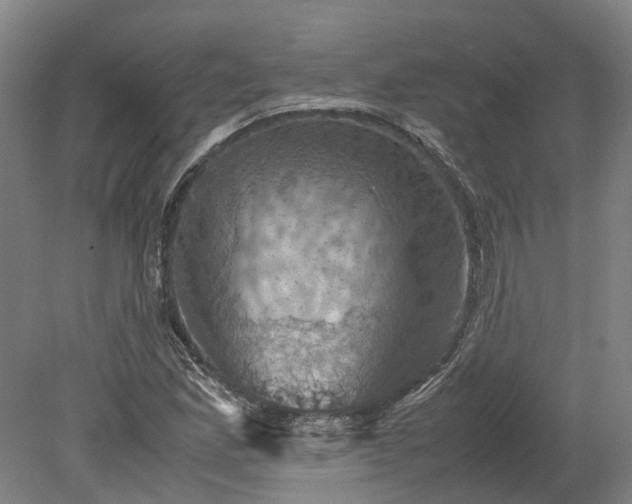 X0000079281165200612011650