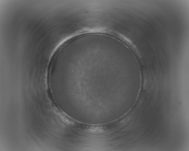 X0000079281174200612011650