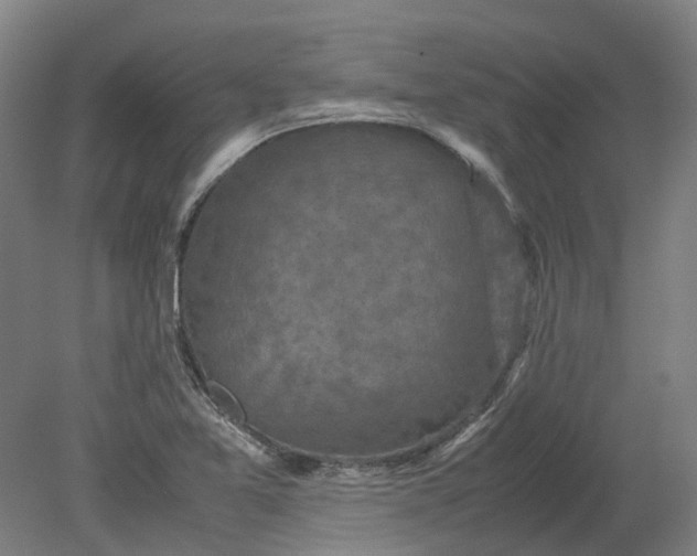 X0000079281365200612011647