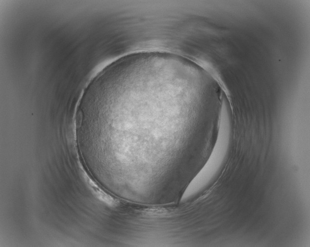 X0000079281388200612011647