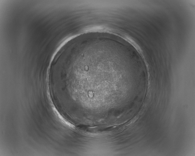X0000079281392200612011647