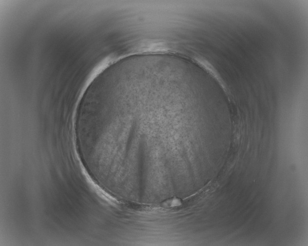 X0000079281475200612011645