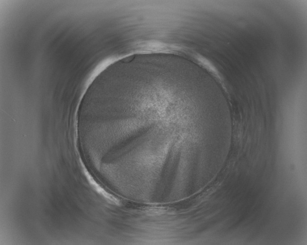 X0000079281479200612011645
