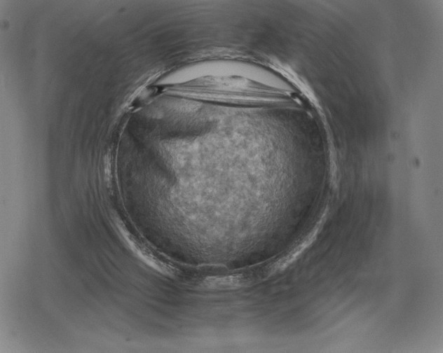 X0000079280057200612081803