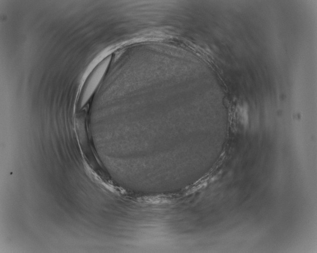 X0000079280100200612081803