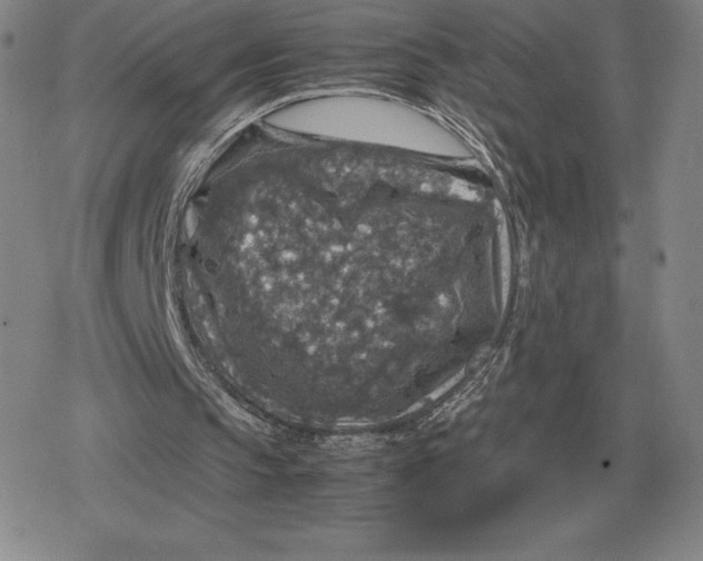 X0000079280145200612081802