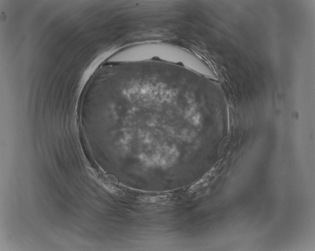 X0000079280147200612081802